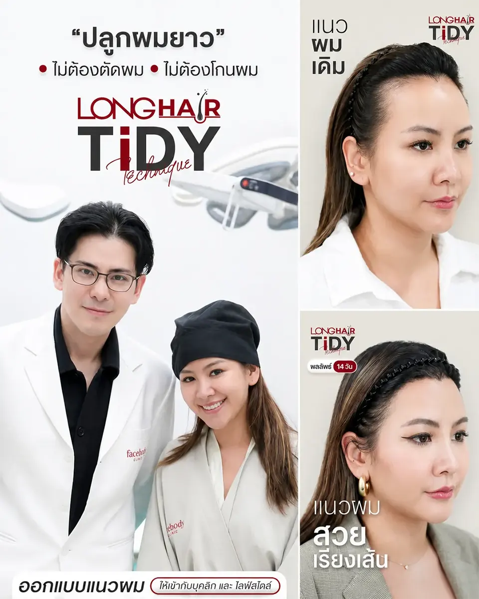 ปลูกผม Long Hair FUE ไม่โกนผม ใช้ชีวิตต่อไม่เสียจังหวะ