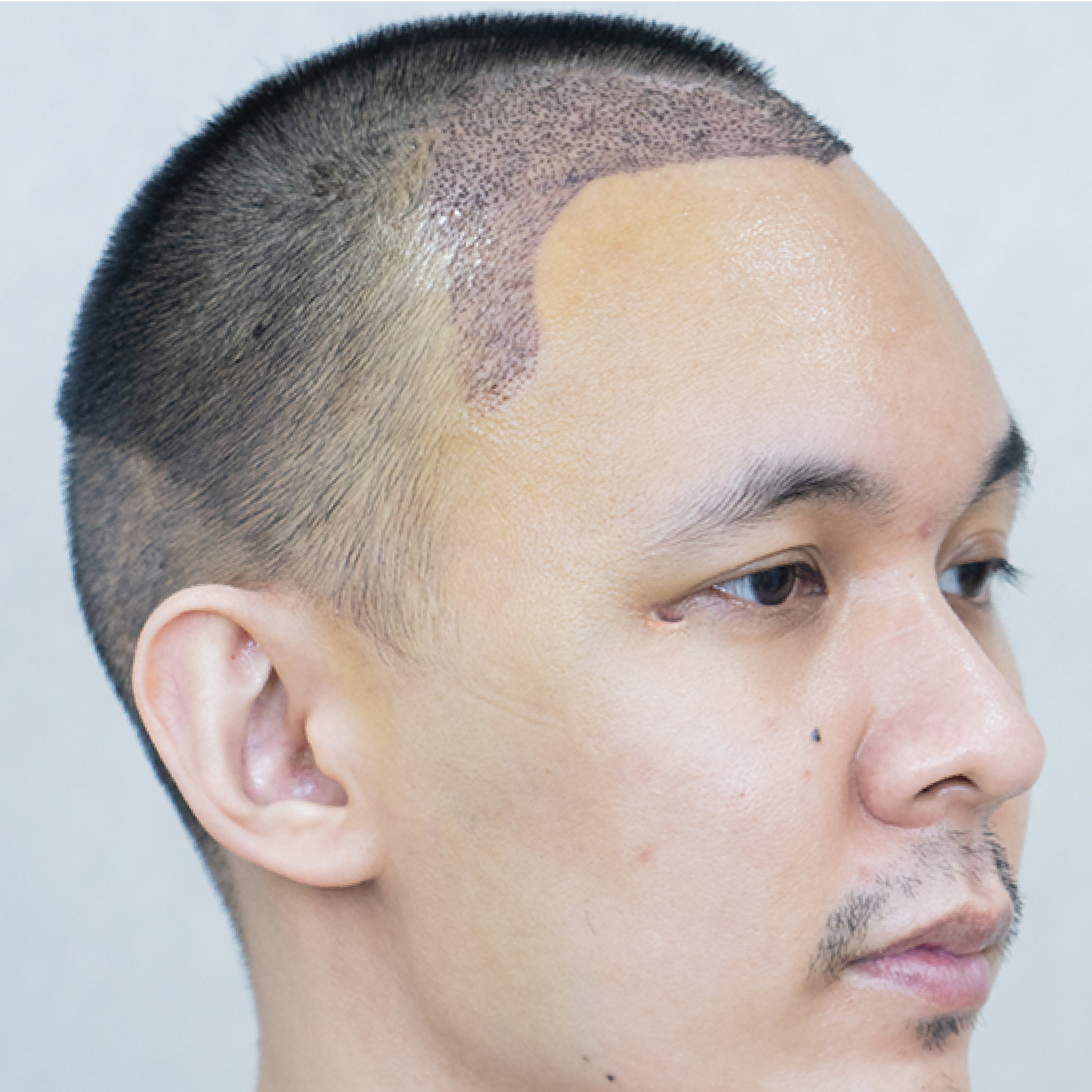 Facebody clinic