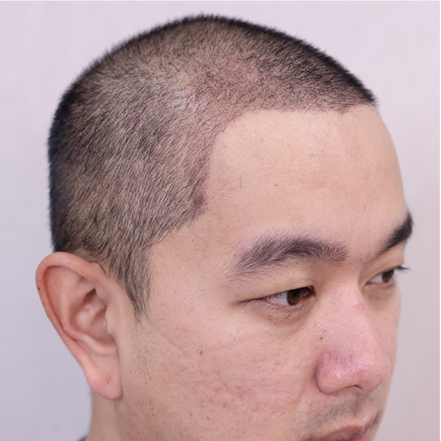 Facebody clinic