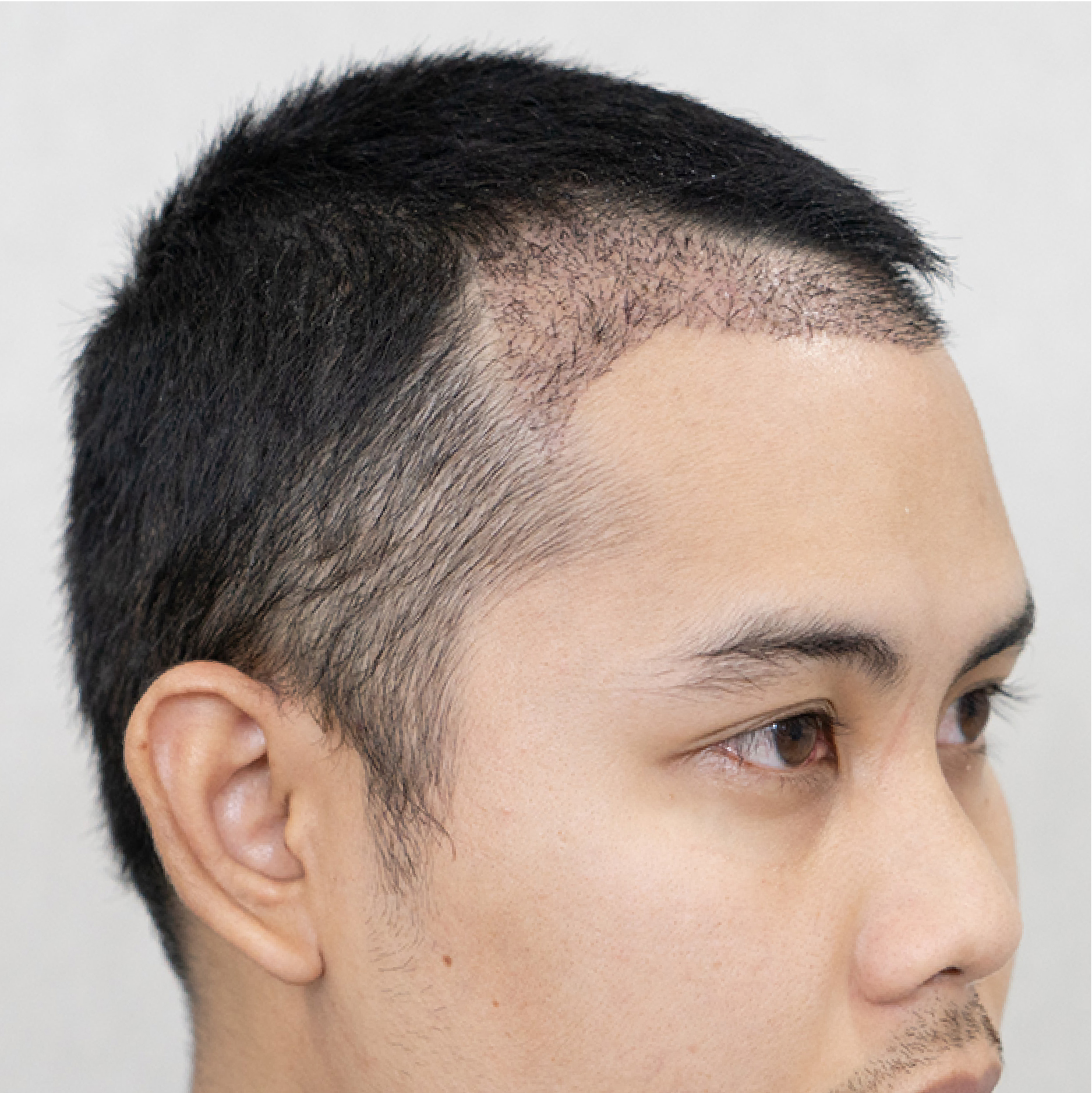 Facebody clinic