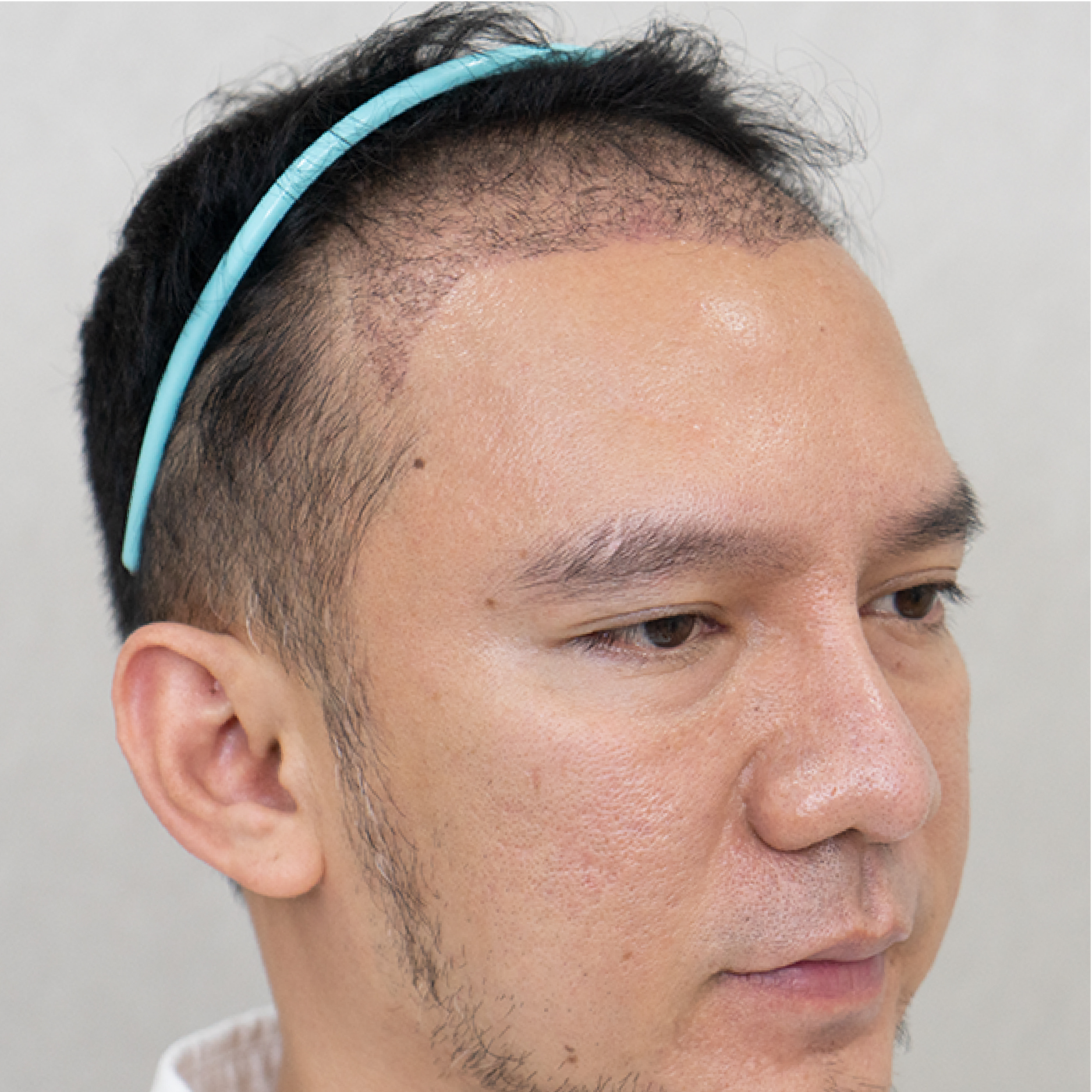 Facebody clinic