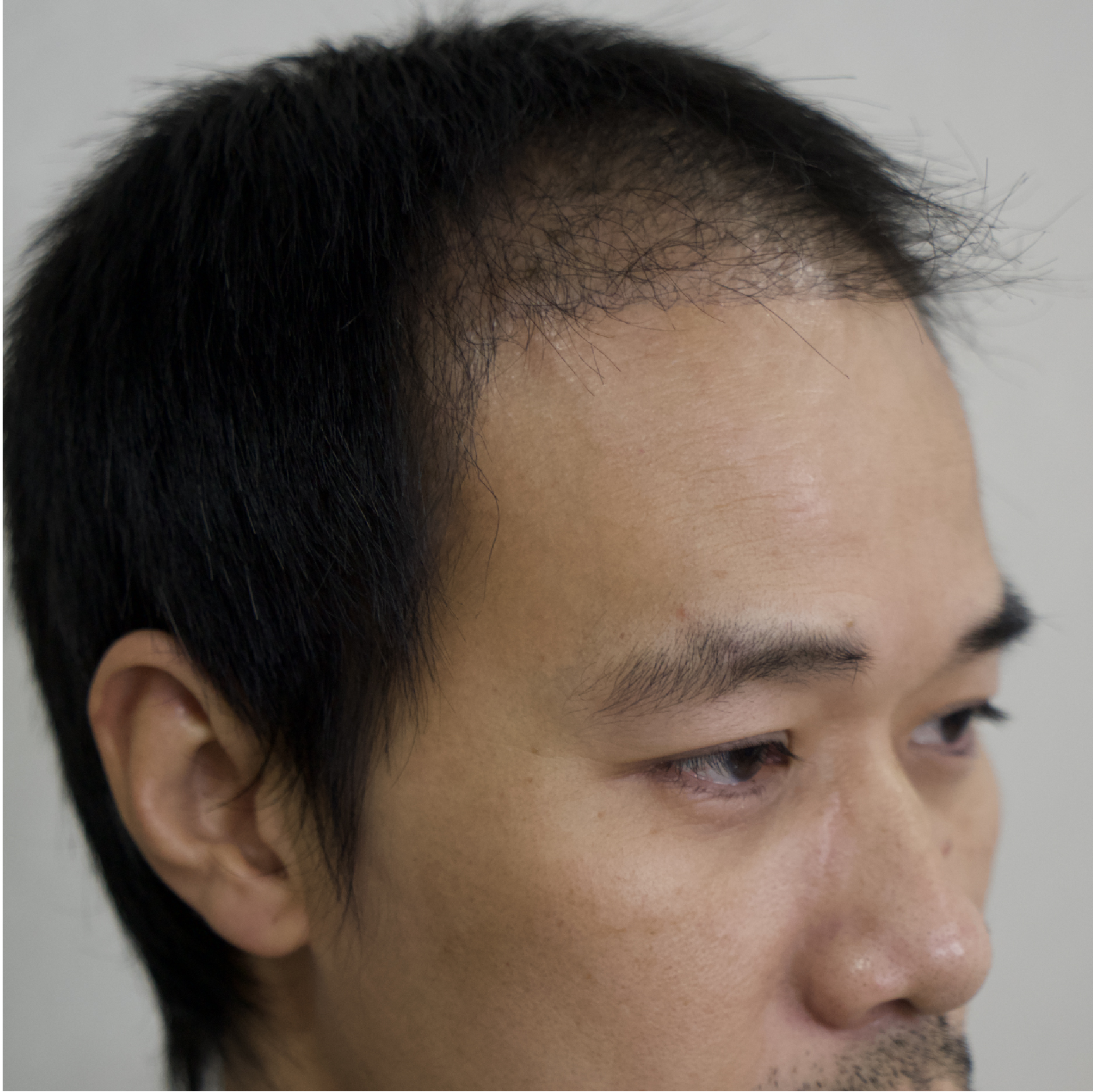 Facebody clinic