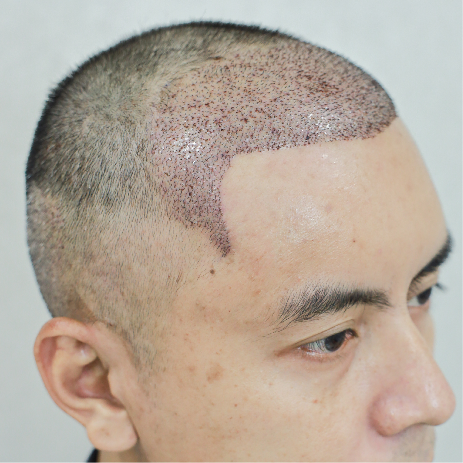 Facebody clinic