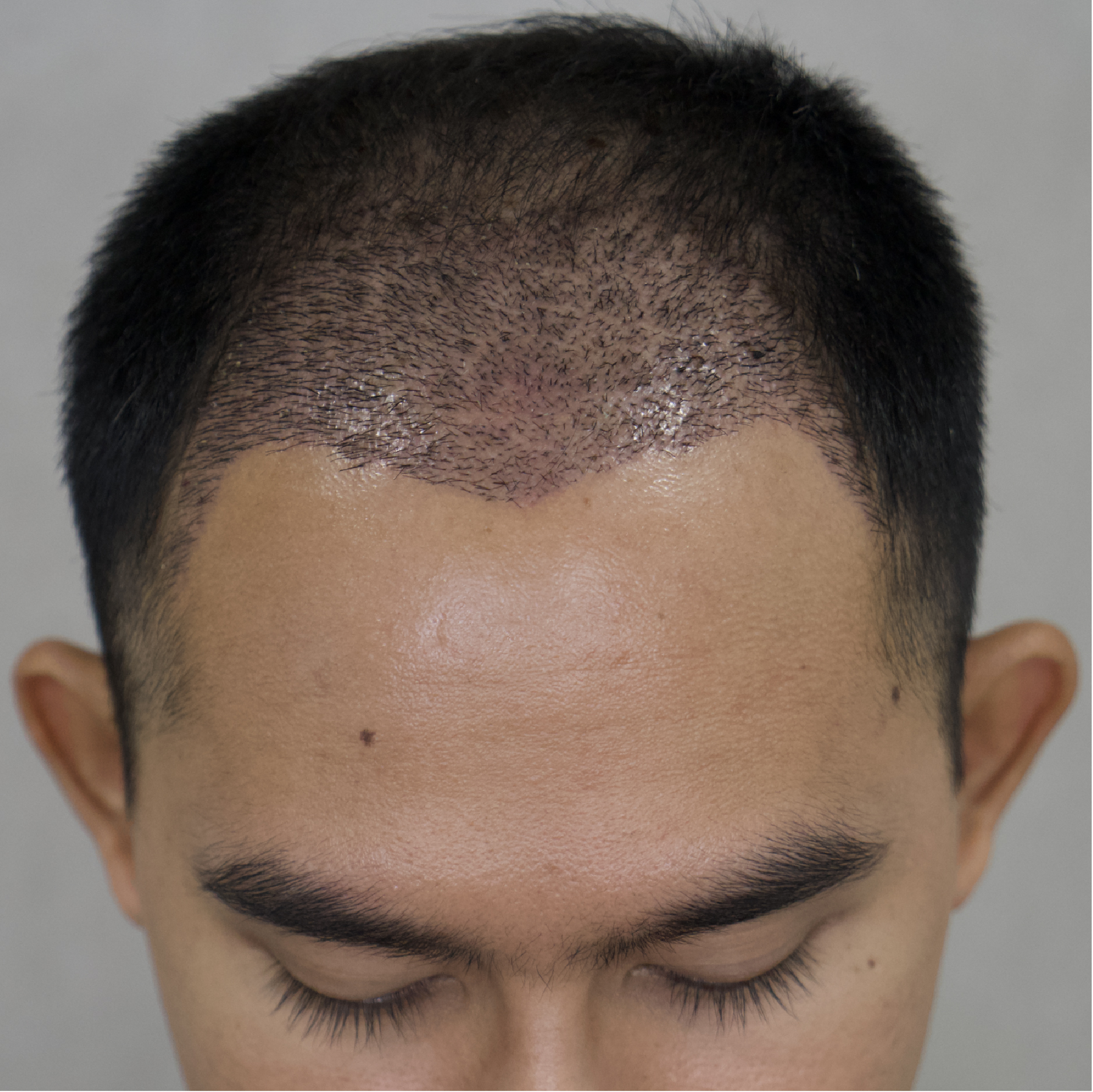 Facebody clinic