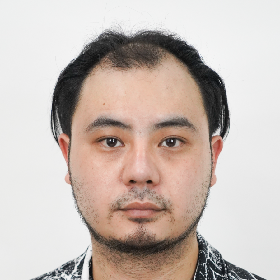 Review-BF-Hair-transplantation-DHI-FUE-C1