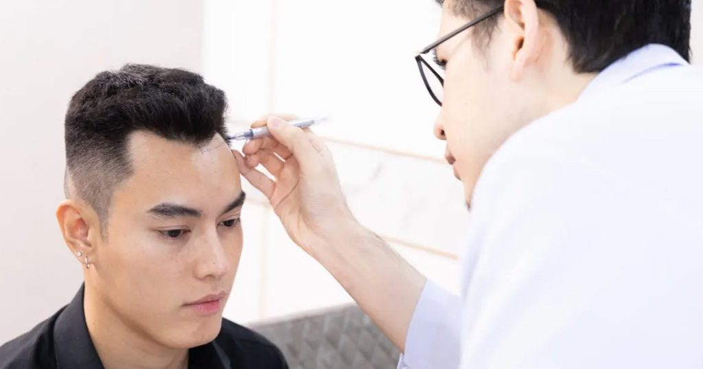 การปลูกผม FUE เป็นทางออกที่ดีของคนผมบาง ศรีษะล้าน ปลอดภัย เป็นธรรมชาติที่สุดสำหรับคนที่มีศีรษะล้านหรือบาง ปลูกผมถาวร เป็นการผ่าตัดเล็กและขั้นตอนสำคัญทั้งหมดจะถูกทำโดยแพทย์ที่ชำนาญการ