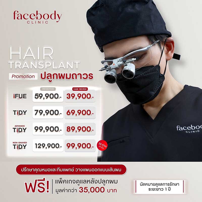 ปลูกผม