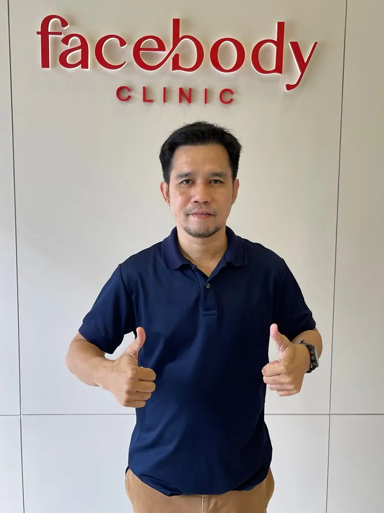6 Month Hair Transplant Review- K Jack