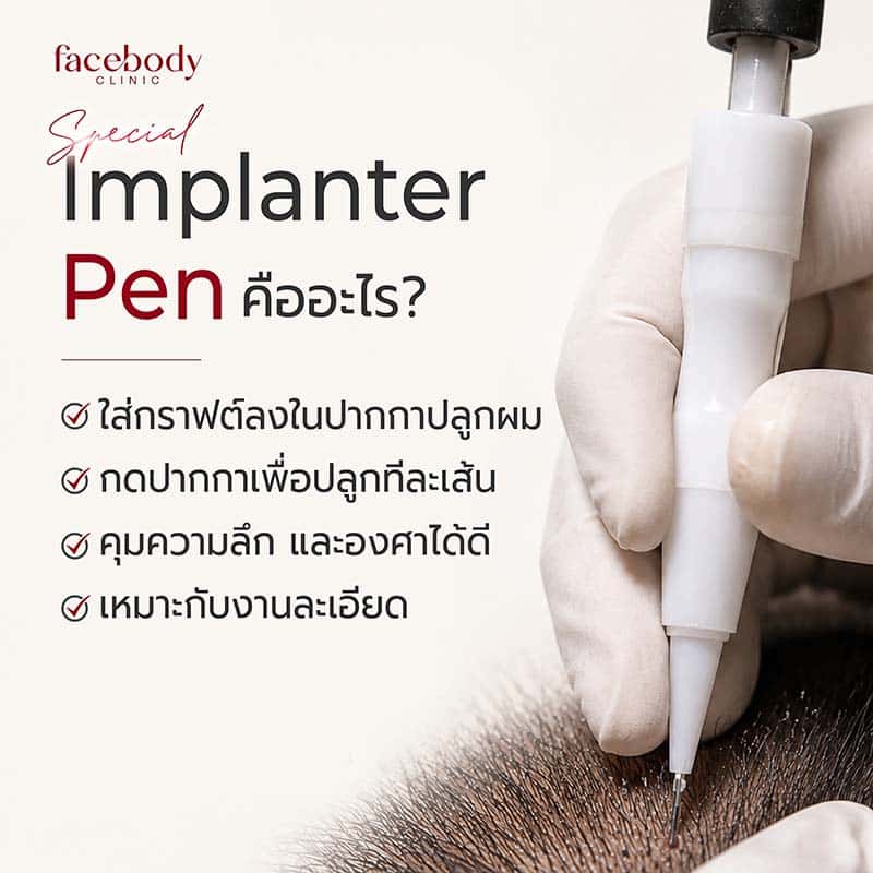 Forceps สามารถปรับมุมและทิศทางของกราฟต์ได้อย่างอิสระ เหมาะกับกราฟต์หลายขนาด ใช้งานได้คล่องในพื้นที่กว้างเป็นเทคนิคที่แพทย์ปลูกผมทั่วโลกใช้มาอย่างยาวนาน