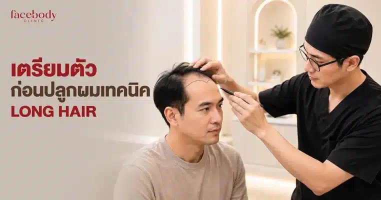 reviewing medications, supplements, scalp health, travel, and pre-op guidelines without stopping prescribed drugs independently. Transferring grafts with long hair attached eliminates the need to shave the donor or recipient areas, providing an immediate preview of the actual hair angle and hairline, requiring minimal downtime, and allowing an immediate return to daily life.