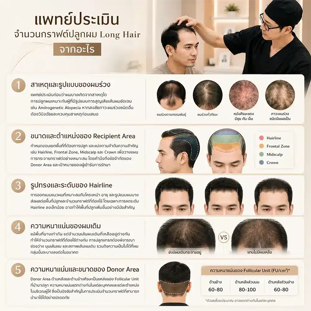 long-hair-transplant-graft-600-2500 graft