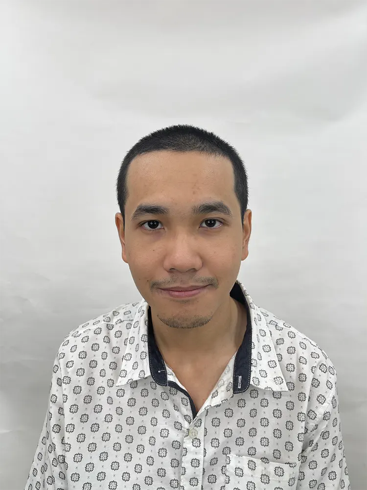 รีวิวปลูกผมครบ 10 เดือน จากประสบการณ์จริงครับ เดิมทีผมเป็นคนหน้าผากค่อนข้างกว้างมาตั้งแต่ช่วงมัธยมปลาย และเริ่มมีปัญหาเส้นผมบางมากขึ้นเรื่อย ๆ