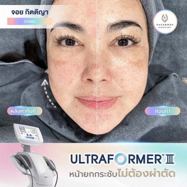 REVIEW ULTRAFORMER 3 Facebody (3)
