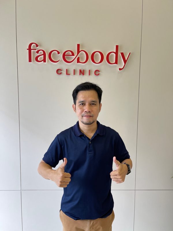 ปลูกผม Facebody 1