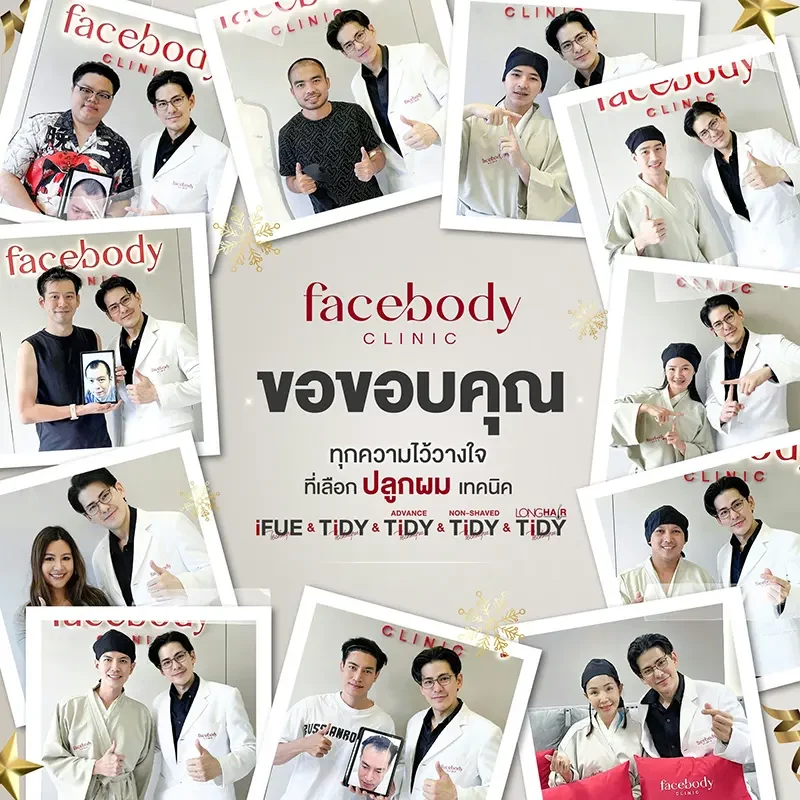 หลังปลูกผม ยืนหน้า BACKDROP